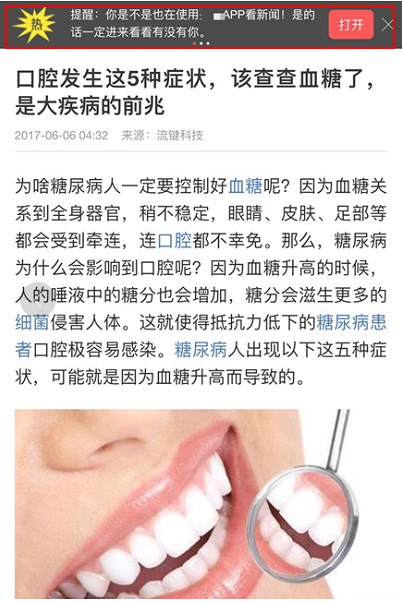 顶部轮播广告