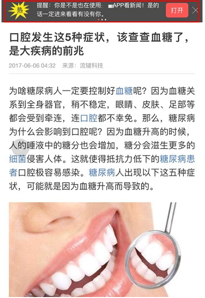 抖动或轮播广告